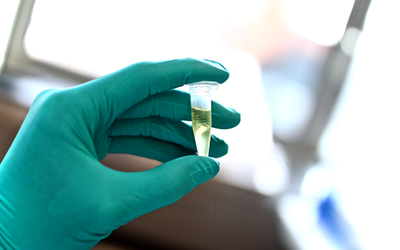 Artel MVS显身手：微升级的移液体积误差可能导致分子水平的癌症分析错误